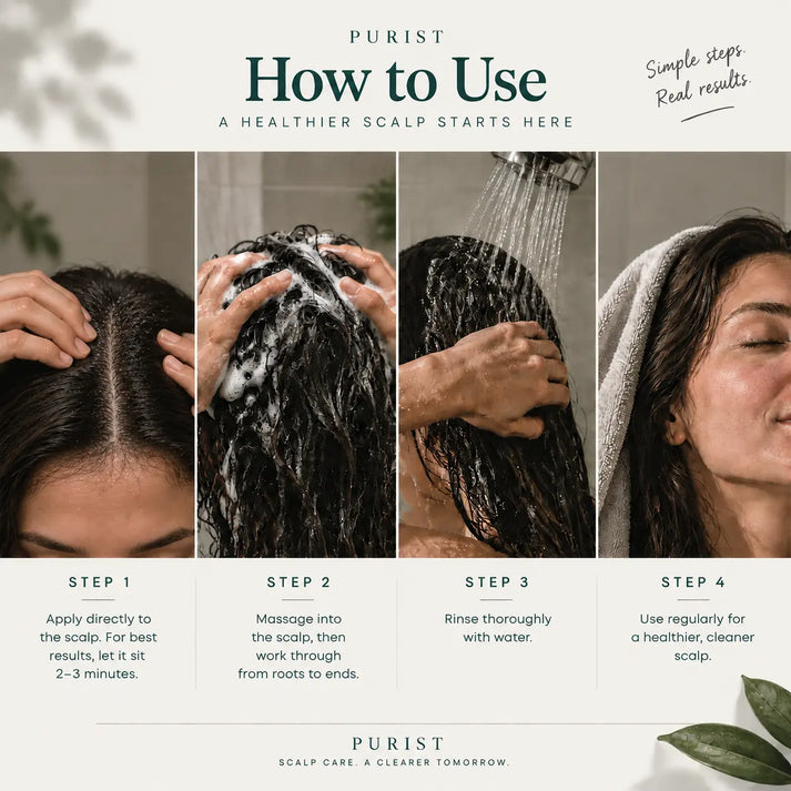 Flake-Free Scalp Essentials