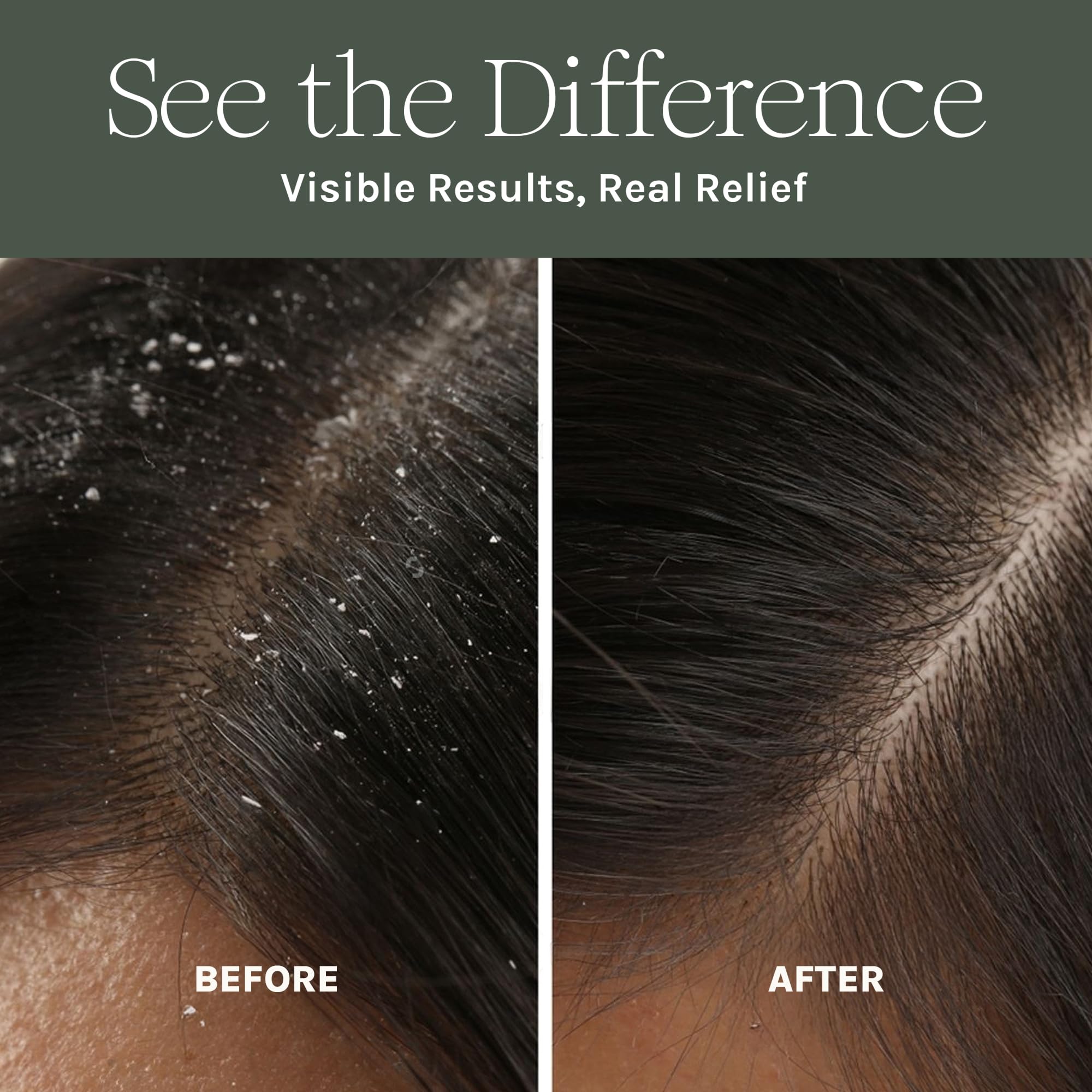 Pure Scalp Mask