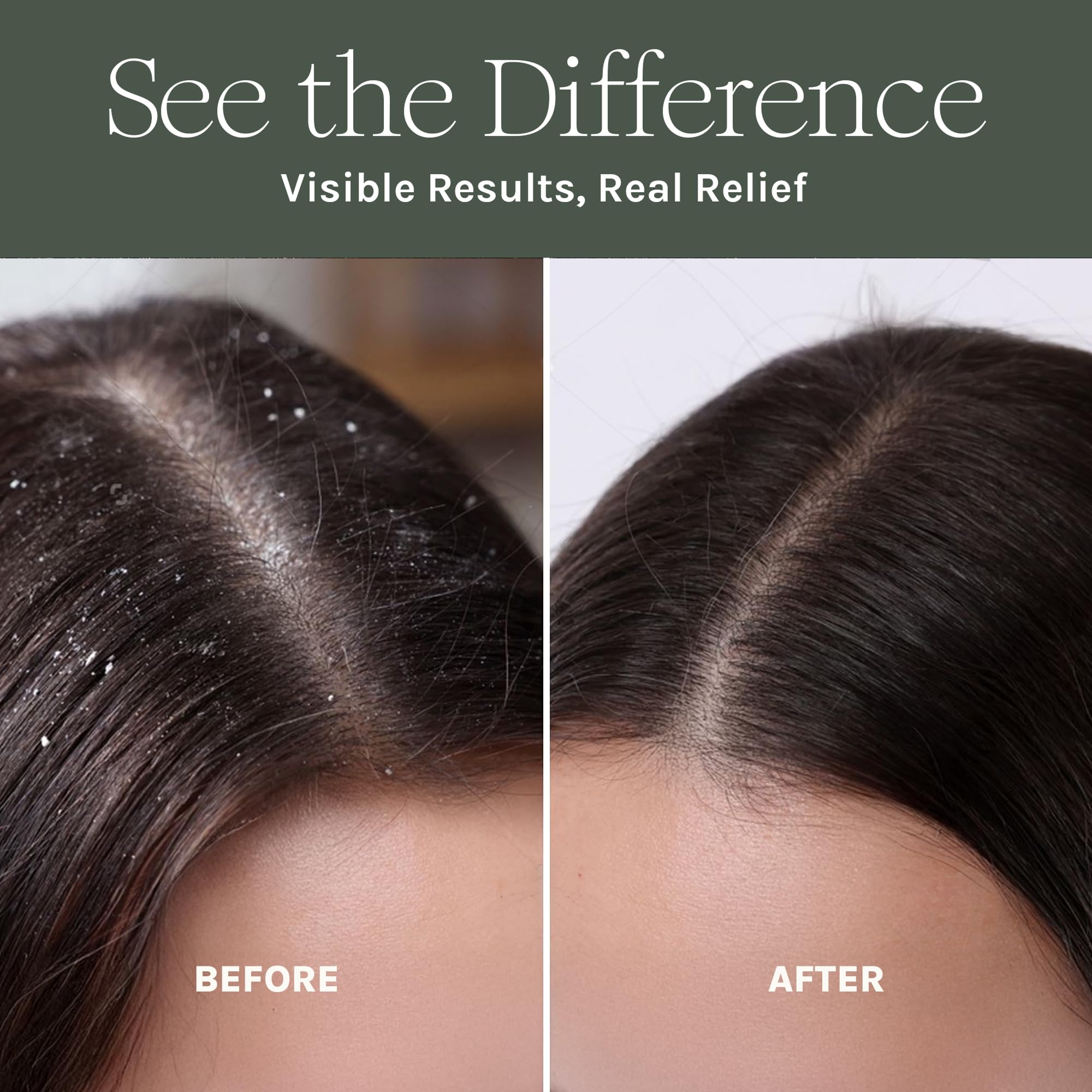 Pure Scalp Shampoo