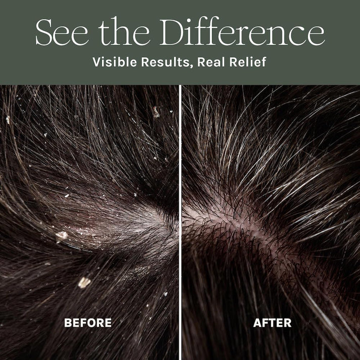 Pure Scalp Relief