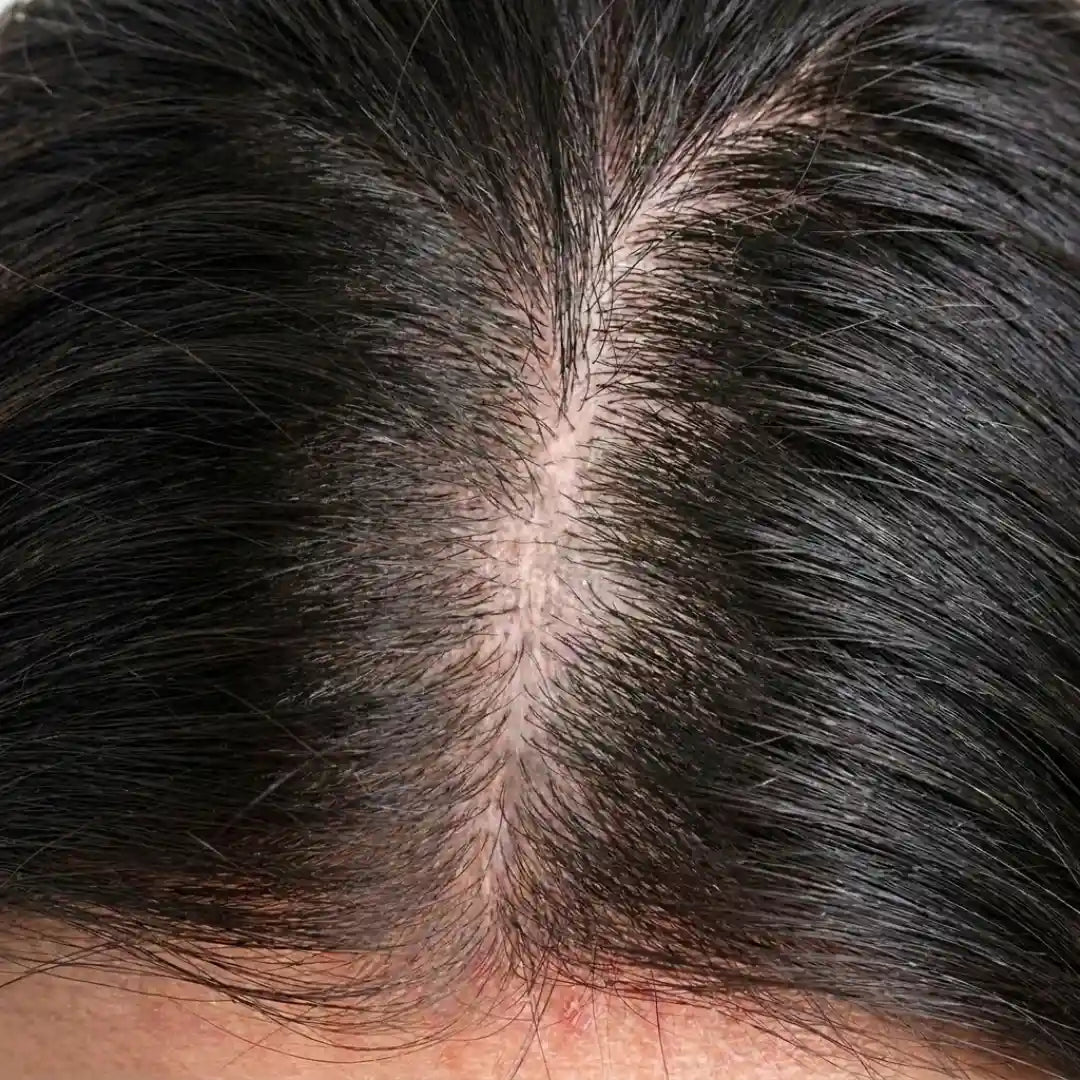 image comparison after